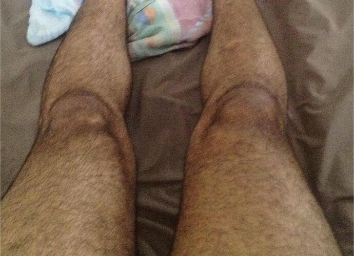 Legs1.jpg