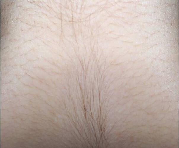 Neck_Back_1.jpg