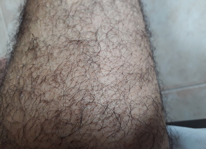 leg.jpg