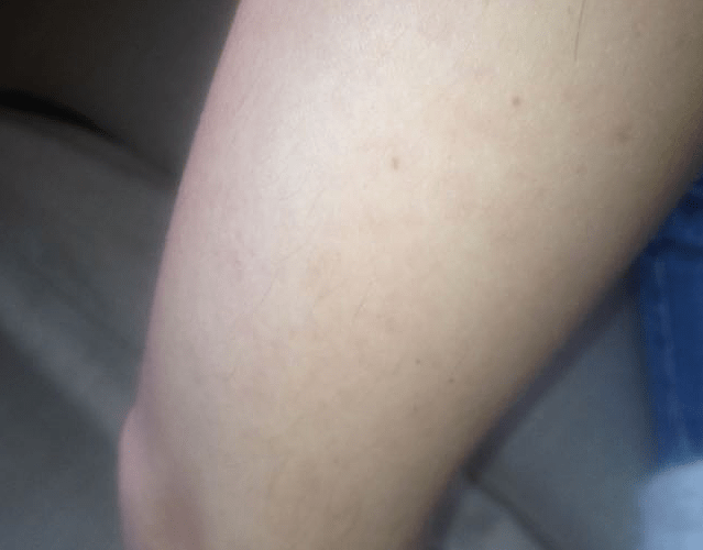 Arms after .png