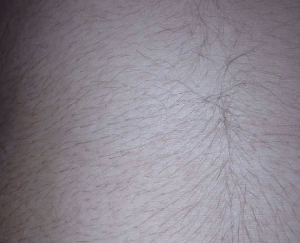 Belly Before 1.png