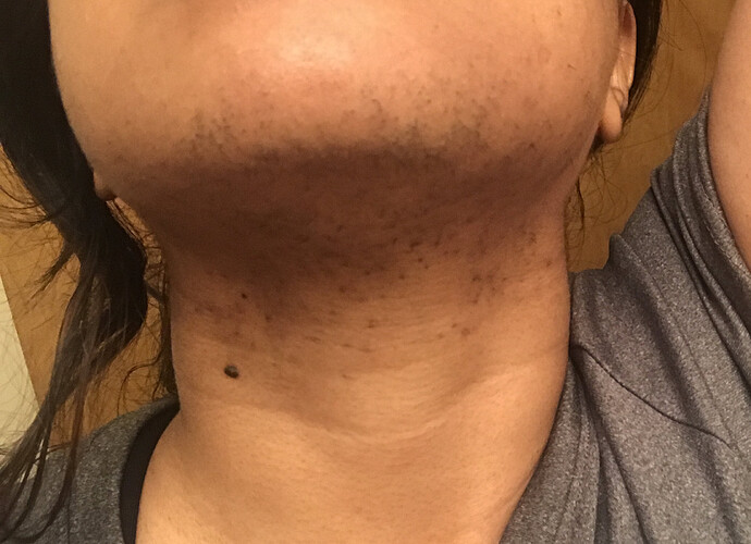 Before Electrolysis.JPG