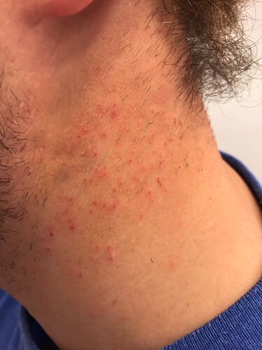 After1stTreatment