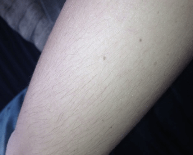 Arms BEFORE.png