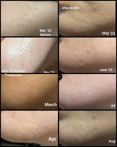 First year month by month, the pitting gets better