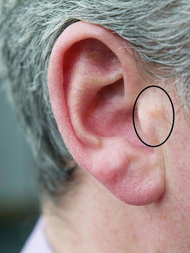 mans-ear-gustoimagesscience-photo-library