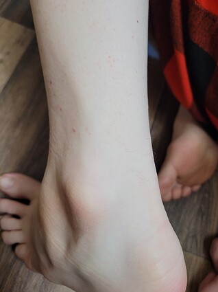 Remaining hair on ankle